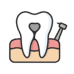 Root Canal Treatment