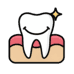 Aesthetic Fillings